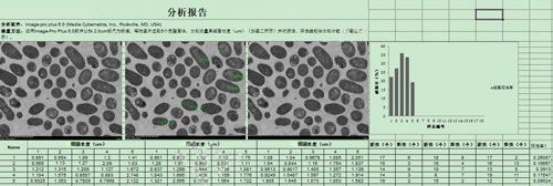 電鏡統計分析