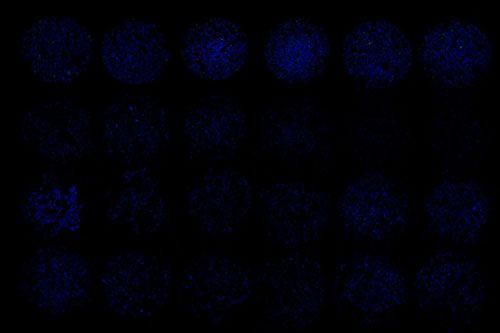 TUNEL（細(xì)胞芯片）檢測